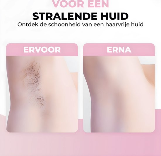 Ontharingsapparaat Dames